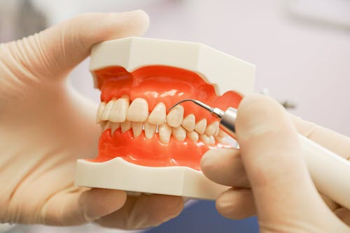 Your dentist can help you prevent a heart attack