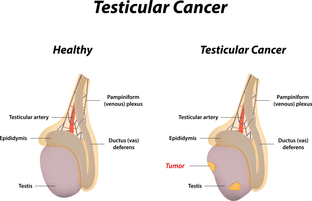 Are Muscle-Building Supplements Linked To Cancer