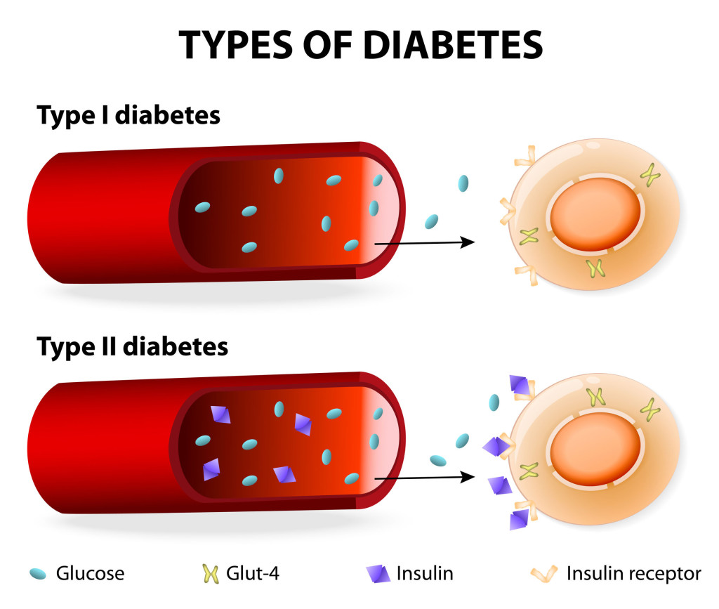 Why haven’t you heard about this diabetes reversal study?