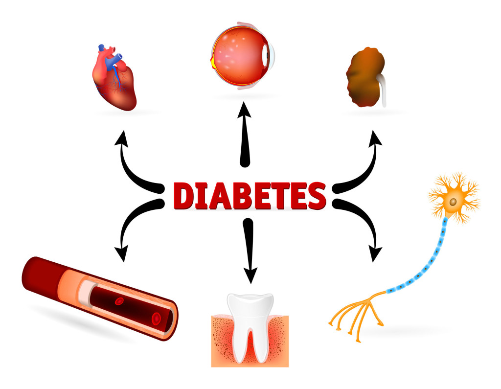 The #1 predictor of amputation in diabetics